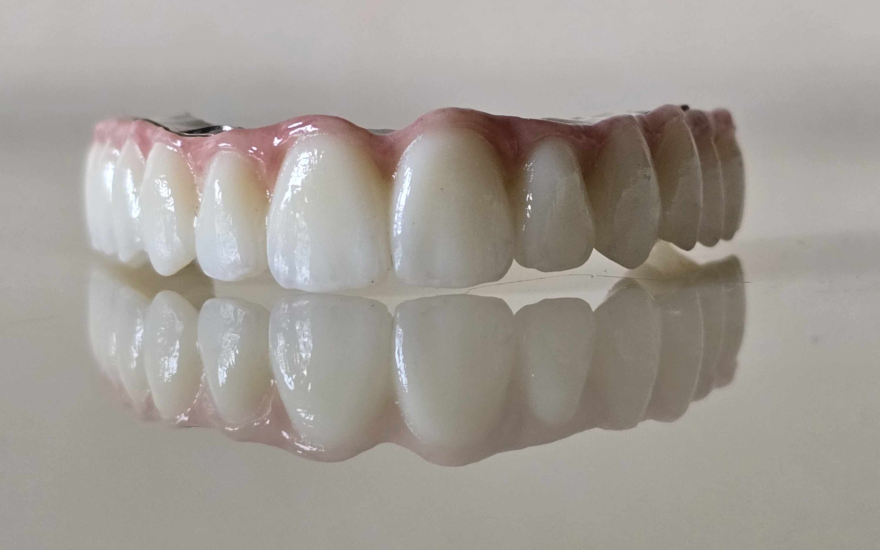 ImplantFix - Dinți definitivi